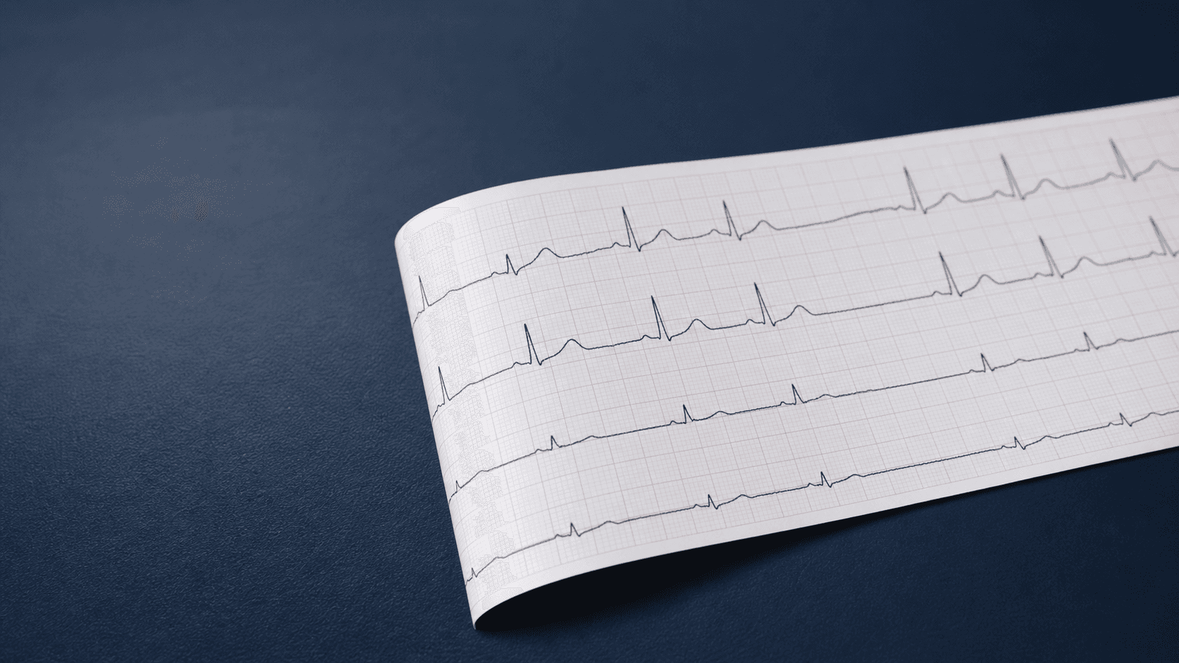 Eletrocardiograma (ECG)